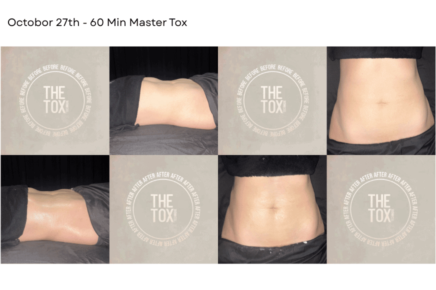 woman's torso showing before and after results from a detox massage at The Tox Chesterfield