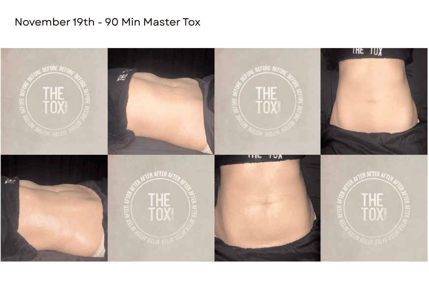 womans torso showing before and after results from a detox massage at The Tox Chesterfield