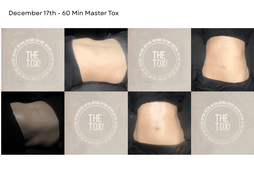 womans torso showing before and after results from a detox massage at The Tox Chesterfield