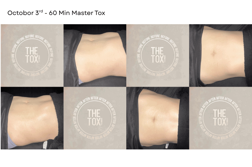 womans torso showing before and after results a detox treatment from The Tox Chesterfield
